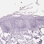 Anti-SP7 antibody produced in rabbit Prestige Antibodies&#174; Powered by Atlas Antibodies, affinity isolated antibody, buffered aqueous glycerol solution