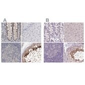 Anti-ACTRT2 antibody produced in rabbit Prestige Antibodies® Powered by Atlas Antibodies, affinity isolated antibody, buffered aqueous glycerol solution