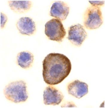 Anti-PERP Antibody from rabbit, purified by affinity chromatography