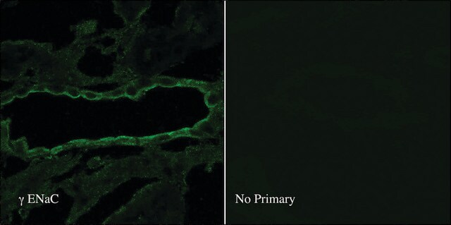 Anti-SCNN1G antibody produced in rabbit 1&#160;mg/mL, affinity isolated antibody