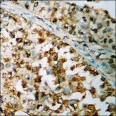 Anti-phospho-IRS-1 (pSer636) antibody produced in rabbit affinity isolated antibody