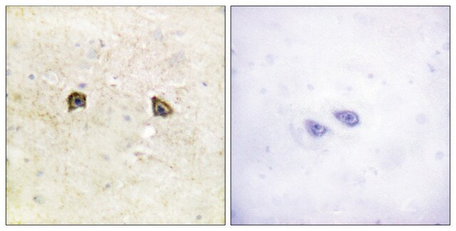 Anti-EPHB1 antibody produced in rabbit affinity isolated antibody