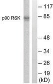 Anti-p90 RSK antibody produced in rabbit affinity isolated antibody