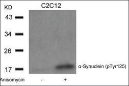Anti-phospho-SNCA (pTyr125) antibody produced in rabbit affinity isolated antibody