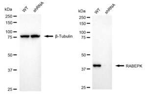 KD-Validated Anti RABEPK Antibody, clone 24GB1540, Rabbit Monoclonal clone 24GB1540, recombinant rabbit monoclonal, expressed in HEK293 cells