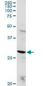 Anti-POMC antibody produced in rabbit purified immunoglobulin, buffered aqueous solution