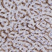Anti-CD36 antibody produced in rabbit Prestige Antibodies&#174; Powered by Atlas Antibodies, affinity isolated antibody, buffered aqueous glycerol solution