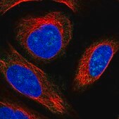 Anti-KLHDC4 antibody produced in rabbit Prestige Antibodies&#174; Powered by Atlas Antibodies, affinity isolated antibody, buffered aqueous glycerol solution