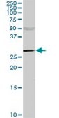 Monoclonal Anti-CA1 antibody produced in mouse clone M2, purified immunoglobulin, buffered aqueous solution