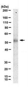 Anti-BMP-10 Antibody