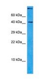 Anti-ASAH1 antibody produced in rabbit affinity isolated antibody