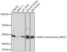 Anti-GABA transaminase (ABAT) Antibody, clone 10V1K9, Rabbit Monoclonal