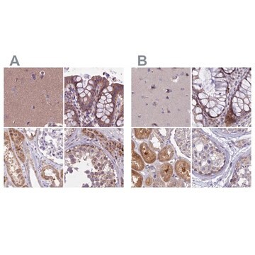 Anti-DUS2 antibody produced in rabbit Prestige Antibodies&#174; Powered by Atlas Antibodies, affinity isolated antibody, buffered aqueous glycerol solution