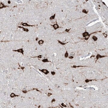 Anti-FAM83B antibody produced in rabbit Prestige Antibodies&#174; Powered by Atlas Antibodies, affinity isolated antibody, buffered aqueous glycerol solution, ab2