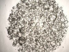 3dGRO Ileum Intestinal Organoids, Age 24 (Prep ht-206-I-CR) Crohns, Ileum, Age: 24, Female, Mutation: Not Available