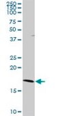 Anti-RNF181 antibody produced in rabbit purified immunoglobulin, buffered aqueous solution