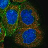 Anti-KRTAP25-1 antibody produced in rabbit Prestige Antibodies&#174; Powered by Atlas Antibodies, affinity isolated antibody, buffered aqueous glycerol solution