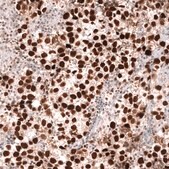 Monoclonal Anti-Msh2 Antibody Produced In Mouse Prestige Antibodies® Powered by Atlas Antibodies, clone CL13713, affinity isolated antibody, buffered aqueous glycerol solution
