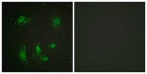 Anti-Survivin antibody produced in rabbit affinity isolated antibody