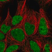 Anti-GTF3C6 antibody produced in rabbit Prestige Antibodies® Powered by Atlas Antibodies, affinity isolated antibody, buffered aqueous glycerol solution