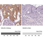 Anti-GALM antibody produced in rabbit Prestige Antibodies&#174; Powered by Atlas Antibodies, affinity isolated antibody, buffered aqueous glycerol solution
