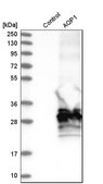 Anti-AQP1 antibody produced in rabbit Prestige Antibodies&#174; Powered by Atlas Antibodies, affinity isolated antibody, buffered aqueous glycerol solution