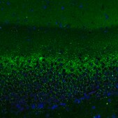 Monoclonal Anti-VGLUT2 antibody produced in mouse Prestige Antibodies® Powered by Atlas Antibodies, clone CL2921, purified immunoglobulin, buffered aqueous glycerol solution