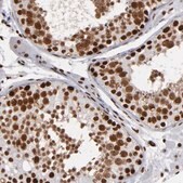 Anti-MRE11 antibody produced in rabbit Prestige Antibodies&#174; Powered by Atlas Antibodies, affinity isolated antibody, buffered aqueous glycerol solution