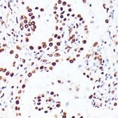 Anti-PML antibody produced in rabbit
