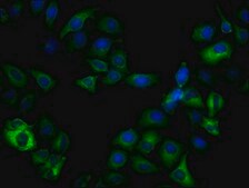 Anti-phospho-GSK3B (Ser9) antibody, clone 3A6, Rabbit Monoclonal recombinant, expressed in HEK293F cells