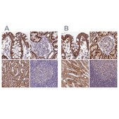 Anti-HSDL2 antibody produced in rabbit Prestige Antibodies® Powered by Atlas Antibodies, affinity isolated antibody, buffered aqueous glycerol solution