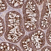 Anti-TOMM40 antibody produced in rabbit Prestige Antibodies&#174; Powered by Atlas Antibodies, affinity isolated antibody, buffered aqueous glycerol solution