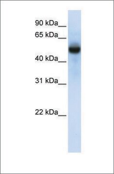 Anti-CXORF34 antibody produced in rabbit affinity isolated antibody