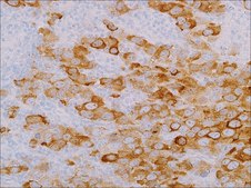 LIN28 (EP150) Rabbit Monoclonal Primary Antibody