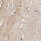 Anti-USP13 antibody produced in rabbit Prestige Antibodies&#174; Powered by Atlas Antibodies, affinity isolated antibody, buffered aqueous glycerol solution