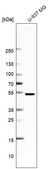 Anti-FAF1 antibody produced in rabbit Prestige Antibodies® Powered by Atlas Antibodies, affinity isolated antibody, buffered aqueous glycerol solution, Ab1