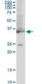 Monoclonal Anti-GAPDH antibody produced in mouse clone 3C2, purified immunoglobulin, buffered aqueous solution