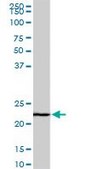 Monoclonal Anti-EFHD1 antibody produced in mouse clone 1F5, purified immunoglobulin, buffered aqueous solution