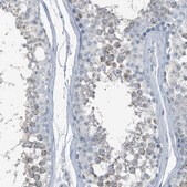 Anti-FAM162A antibody produced in rabbit Prestige Antibodies&#174; Powered by Atlas Antibodies, affinity isolated antibody, buffered aqueous glycerol solution