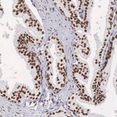 抗-HMGN5 兔抗 Prestige Antibodies® Powered by Atlas Antibodies, affinity isolated antibody, buffered aqueous glycerol solution