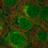 Anti-TMEM176B antibody produced in rabbit Prestige Antibodies® Powered by Atlas Antibodies, affinity isolated antibody, buffered aqueous glycerol solution