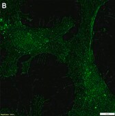 Anti-Neuropilin-1 Antibody, clone 1H21 ZooMAb&#174; Rabbit Monoclonal recombinant, expressed in HEK 293 cells