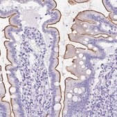 Anti-SLC13A2 antibody produced in rabbit Prestige Antibodies&#174; Powered by Atlas Antibodies, affinity isolated antibody, buffered aqueous glycerol solution