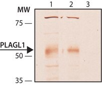 Anti-PLAGL1 antibody produced in rabbit ~1.0 mg/mL, affinity isolated antibody, buffered aqueous solution