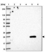 Anti-FAM156A antibody produced in rabbit Prestige Antibodies® Powered by Atlas Antibodies, affinity isolated antibody, buffered aqueous glycerol solution