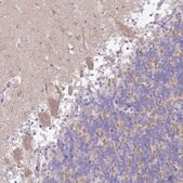 Anti-TMEM246 antibody produced in rabbit Prestige Antibodies&#174; Powered by Atlas Antibodies, affinity isolated antibody, buffered aqueous glycerol solution