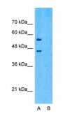 Anti-SLC15A4 antibody produced in rabbit affinity isolated antibody