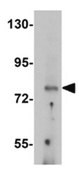 Anti-UHRF1BP1 Antibody from rabbit, purified by affinity chromatography