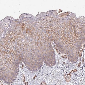 Anti-RPL23A antibody produced in rabbit Prestige Antibodies&#174; Powered by Atlas Antibodies, affinity isolated antibody, buffered aqueous glycerol solution