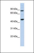 Anti-PPME1, (N-terminal) antibody produced in rabbit affinity isolated antibody